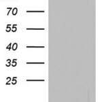 C11orf67 (AAMDC) monoclonal antibody