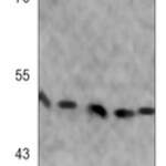 SMAD3 (Phospho-S423/425) Rabbit monoclonal antibody