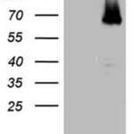 ESR1 monoclonal antibody