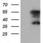 Anti-DYNC1LI1 monoclonal antibody