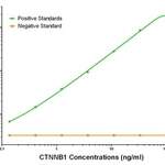 CTNNB1 Capture Antibody (OAOA21488)
