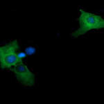MAP2K2 Monoclonal Antibody (OTI1A2), TrueMAB™