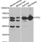 Anti TP53 Antibody