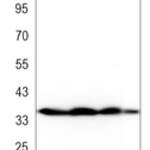 p38 Rabbit monoclonal antibody