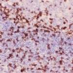 CD3 epsilon Antibody (R31519)