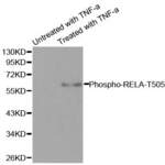 Anti Phospho RELA T505 Antibody