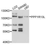 RelA-Associated Inhibitor (PPP1R13L) Antibody
