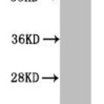 Mono-methyl-HIST1H3A (K64) Antibody