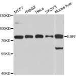 ESR1 Polyclonal Antibody