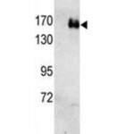 HER2 Antibody (F50602)