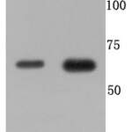TNFR2 polyclonal antibody