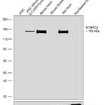 MYBPC3 Recombinant Rabbit Monoclonal Antibody (19H1L3)