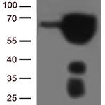 ESR1 monoclonal antibody