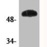 Phospho-TP53 (S46) Antibody