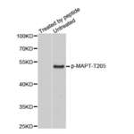 MAPT (pT205) Antibody