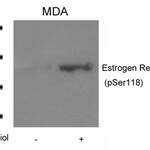 Phospho-ESR1 (Ser118) Antibody