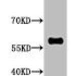 Mono-Methyl-RELA  (K314/K315) Antibody