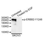ERBB2 (pY1248) Antibody