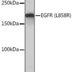 EGFR Recombinant Rabbit Monoclonal Antibody (ARC1139)