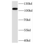 RelA-Associated Inhibitor (PPP1R13L) Antibody