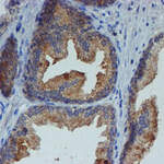 ESR1 Monoclonal Antibody (OTI1B1), TrueMAB™