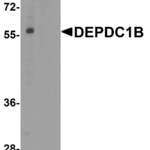 DEPDC1B Antibody
