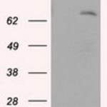 LTA4H (Leukotriene A4 hydrolase) monoclonal antibody