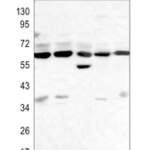 Beclin-1 Rabbit monoclonal antibody