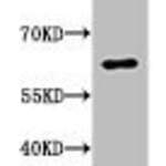 Acetyl-RELA (K310) Antibody