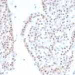 Recombinant SF-1 Antibody / Steroidogenic Factor 1 / NR5A1 [clone NR5A1/4368R] (V9450)