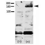 Phospho-HER4/ERBB4 Antibody (pY1188) (F48404)