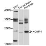 v Channel Interacting Protein 1 (KCNIP1) Antibody