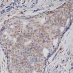 Anti-CD44 Rabbit Monoclonal Antibody, Clone RM264