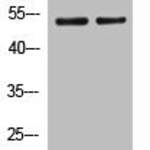 Phospho-SGK1 (S422) Antibody