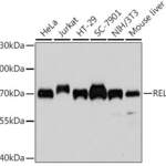 NF-kB p65 Monoclonal Antibody
