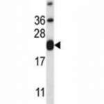 CD3e Antibody (F43038)