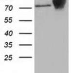 CTNNB1 monoclonal antibody