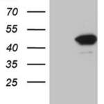 FBXO22 Monoclonal Antibody (OTI1H1)