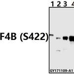 eIF4B (phospho-S422) polyclonal antibody 