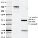 ErbB2 Antibody / HER2 [clone HRB2/258] (V2109)