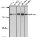 Moesin Recombinant Rabbit Monoclonal Antibody (ARC1258)