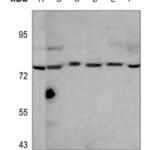 CD19 polyclonal antibody