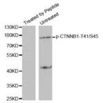 CTNNB1 (pY41 / S45) Antibody