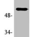 Phospho-TP53 (S9) Antibody