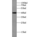 Aurora Kinase B (AURKB) Antibody