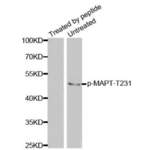 MAPT (pT231) Antibody
