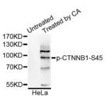 CTNNB1 (pS45) Antibody