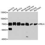 Transcription Factor P65 (RELA) Antibody