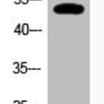 Acetyl-TP53 (K320) Antibody