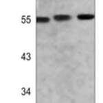 AKT (Phospho-S473) Rabbit monoclonal antibody